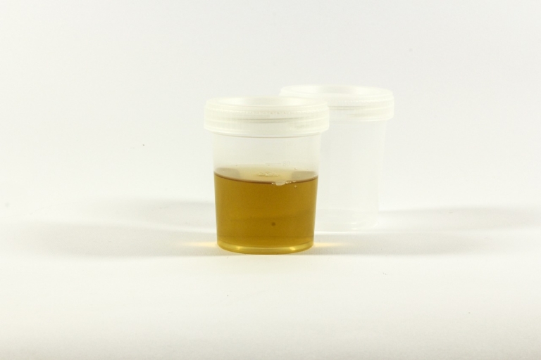 Does Delta 8 Show Up On Drug Tests